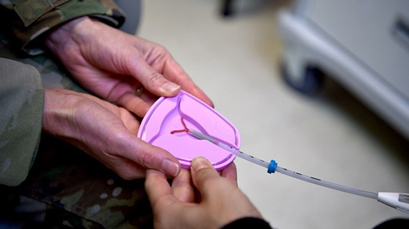 Contraceptive Services